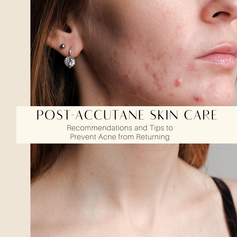 Post-Accutane Skin Care: Recommendations and Tips to Prevent Acne from Returning