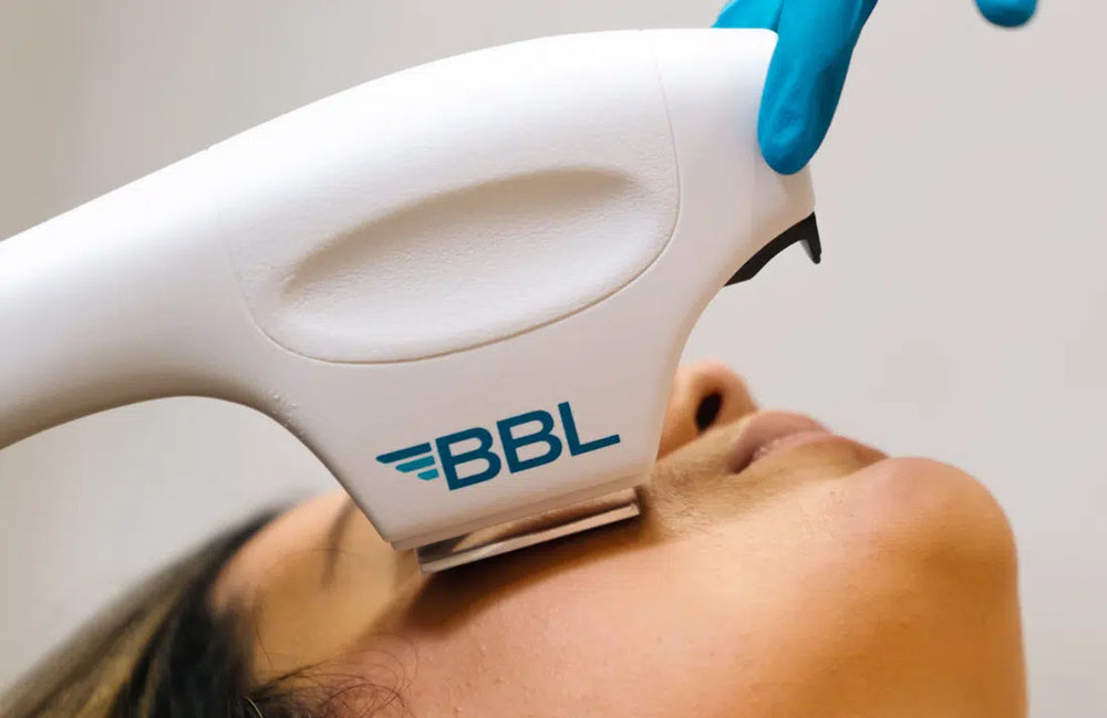 BBL machine been applied on a patients face