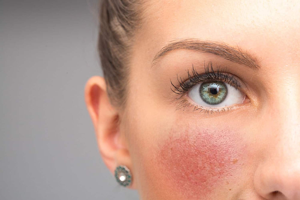 The Skin Lab Approach