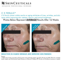 SkinCeuticals CE Ferulic® with 15% L-Ascorbic Acid