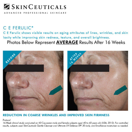 SkinCeuticals CE Ferulic® with 15% L-Ascorbic Acid