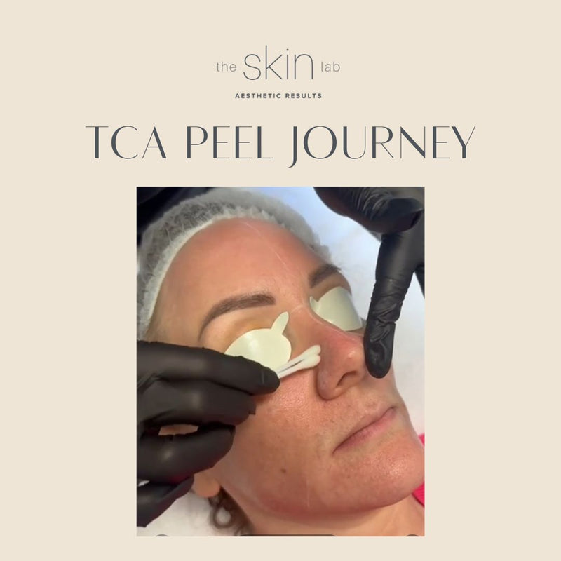 Case Study: Erin's Experience with the TCA Peel