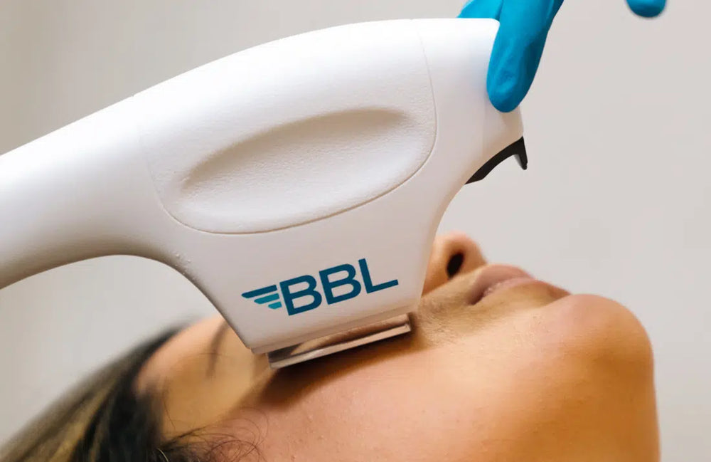 BBL machine been applied on a patients face 