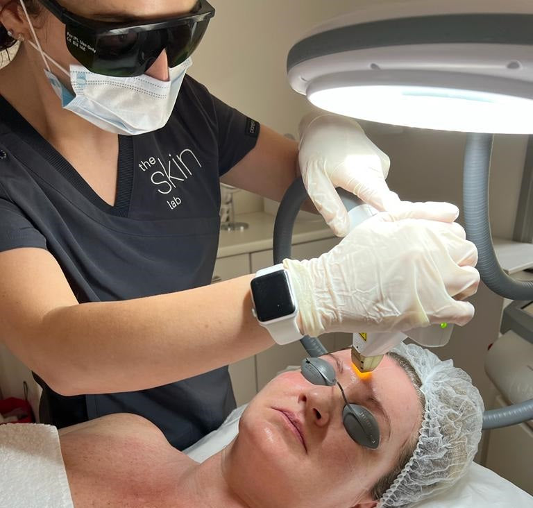 ICON IPL: What to expect at The Skin Lab